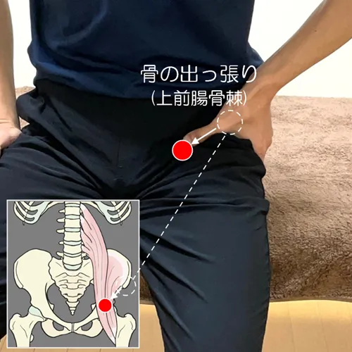 腸腰筋ポイント