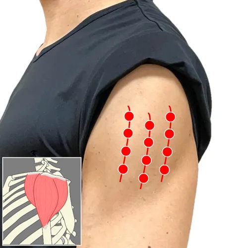 腕や肩が重だるい時